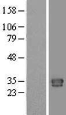 Western Blot: CTRP1 Overexpression Lysate (Adult Normal) [NBP2-06153] Left-Empty vector transfected control cell lysate (HEK293 cell lysate); Right -Over-expression Lysate for CTRP1.