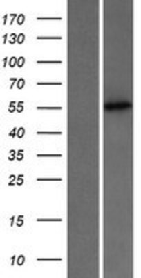 Western Blot: PUS3 Overexpression Lysate (Adult Normal) [NBP2-06135] Left-Empty vector transfected control cell lysate (HEK293 cell lysate); Right -Over-expression Lysate for PUS3.