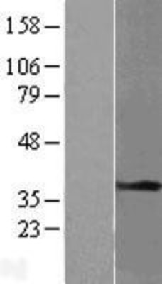 Western Blot: Tropomyosin-1 Overexpression Lysate (Adult Normal) [NBP2-11232] Left-Empty vector transfected control cell lysate (HEK293 cell lysate); Right -Over-expression Lysate for Tropomyosin-1.
