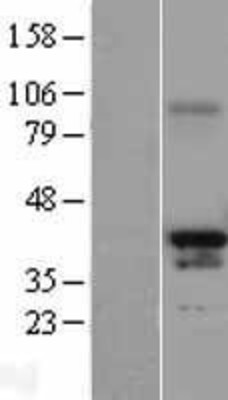 Western Blot: PAX4 Overexpression Lysate (Adult Normal) [NBL1-14130] Left-Empty vector transfected control cell lysate (HEK293 cell lysate); Right -Over-expression Lysate for PAX4.