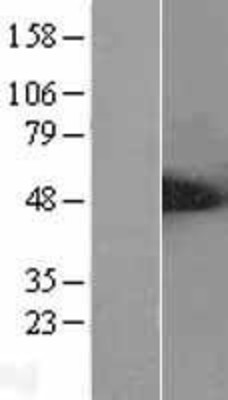 Western Blot: ALS2CR2 Overexpression Lysate (Adult Normal) [NBL1-07490] Left-Empty vector transfected control cell lysate (HEK293 cell lysate); Right -Over-expression Lysate for ALS2CR2.