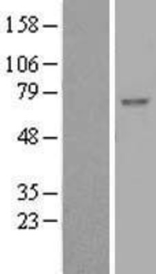 Western Blot: betaTrCP Overexpression Lysate (Adult Normal) [NBL1-08055] Left-Empty vector transfected control cell lysate (HEK293 cell lysate); Right -Over-expression Lysate for betaTrCP.