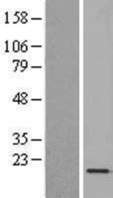 Western Blot: C1orf115 Overexpression Lysate (Adult Normal) [NBL1-08293] Left-Empty vector transfected control cell lysate (HEK293 cell lysate); Right -Over-expression Lysate for C1orf115.