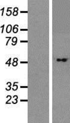 Western Blot: BTBD1 Overexpression Lysate (Adult Normal) [NBP2-06212] Left-Empty vector transfected control cell lysate (HEK293 cell lysate); Right -Over-expression Lysate for BTBD1.