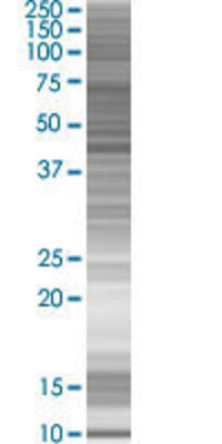 ACTR10 transfected lysate.
