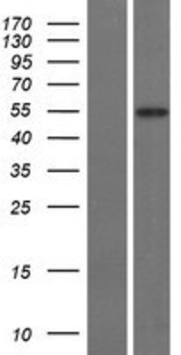 Western Blot: GLUT10 Overexpression Lysate (Adult Normal) [NBP2-06187] Left-Empty vector transfected control cell lysate (HEK293 cell lysate); Right -Over-expression Lysate for GLUT10.