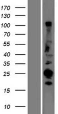 Western Blot: CABP1 Overexpression Lysate (Adult Normal) [NBP2-06144] Left-Empty vector transfected control cell lysate (HEK293 cell lysate); Right -Over-expression Lysate for CABP1.