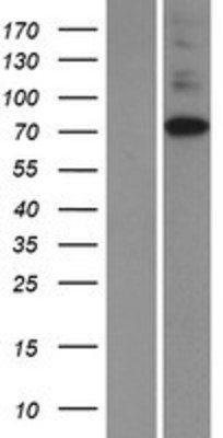 Western Blot: IP3KC Overexpression Lysate (Adult Normal) [NBP2-06227] Left-Empty vector transfected control cell lysate (HEK293 cell lysate); Right -Over-expression Lysate for IP3KC.