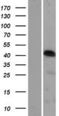 Western Blot: CCDC34 Overexpression Lysate (Adult Normal) [NBP2-06189] Left-Empty vector transfected control cell lysate (HEK293 cell lysate); Right -Over-expression Lysate for CCDC34.