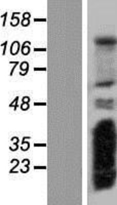 Western Blot: RSG1 Overexpression Lysate (Adult Normal) [NBP2-06166] Left-Empty vector transfected control cell lysate (HEK293 cell lysate); Right -Over-expression Lysate for RSG1.