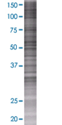 POLK transfected lysate.