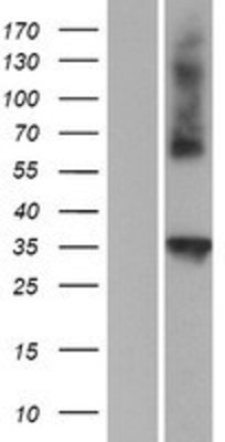 Western Blot: CTRP4 Overexpression Lysate (Adult Normal) [NBP2-06105] Left-Empty vector transfected control cell lysate (HEK293 cell lysate); Right -Over-expression Lysate for CTRP4.