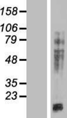 Western Blot: MAP4 Overexpression Lysate (Adult Normal) [NBP2-06172] Left-Empty vector transfected control cell lysate (HEK293 cell lysate); Right -Over-expression Lysate for MAP4.