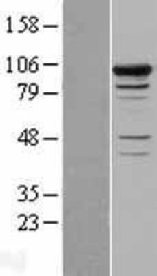Western Blot: Smek1 Overexpression Lysate (Adult Normal) [NBL1-16241] Left-Empty vector transfected control cell lysate (HEK293 cell lysate); Right -Over-expression Lysate for Smek1.