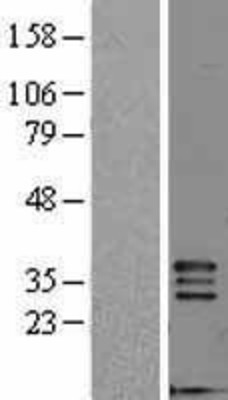 Western Blot: FGF5 Overexpression Lysate (Adult Normal) [NBL1-10698] Left-Empty vector transfected control cell lysate (HEK293 cell lysate); Right -Over-expression Lysate for FGF5.