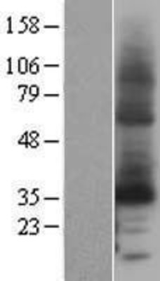 Western Blot: Cytochrome b reductase 1 Overexpression Lysate (Adult Normal) [NBL1-09660] Left-Empty vector transfected control cell lysate (HEK293 cell lysate); Right -Over-expression Lysate for Cytochrome b reductase 1.
