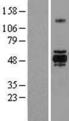 Western Blot: GSK3 alpha Overexpression Lysate (Adult Normal) [NBL1-11361] Left-Empty vector transfected control cell lysate (HEK293 cell lysate); Right -Over-expression Lysate for GSK3 alpha.