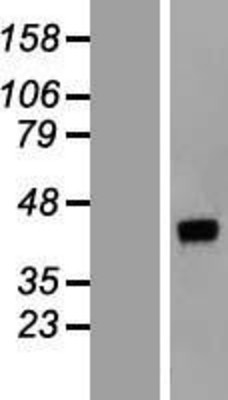 Western Blot: DNAJB14 Overexpression Lysate (Adult Normal) [NBL1-09935] Left-Empty vector transfected control cell lysate (HEK293 cell lysate); Right -Over-expression Lysate for DNAJB14.