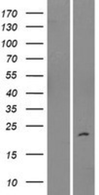 Western Blot: IMMP2L Overexpression Lysate (Adult Normal) [NBP2-06000] Left-Empty vector transfected control cell lysate (HEK293 cell lysate); Right -Over-expression Lysate for IMMP2L.