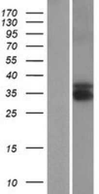 Western Blot: TEX13B Overexpression Lysate (Adult Normal) [NBP2-06148] Left-Empty vector transfected control cell lysate (HEK293 cell lysate); Right -Over-expression Lysate for TEX13B.
