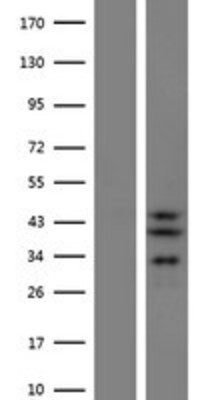 Western Blot: SLC25A28 Overexpression Lysate (Adult Normal) [NBP2-06146] Left-Empty vector transfected control cell lysate (HEK293 cell lysate); Right -Over-expression Lysate for SLC25A28.