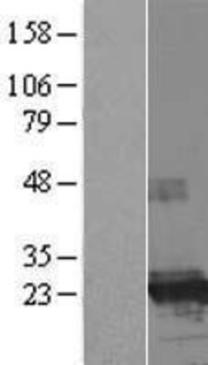 Western Blot: FTHL17 Overexpression Lysate (Adult Normal) [NBP2-06110] Left-Empty vector transfected control cell lysate (HEK293 cell lysate); Right -Over-expression Lysate for FTHL17.