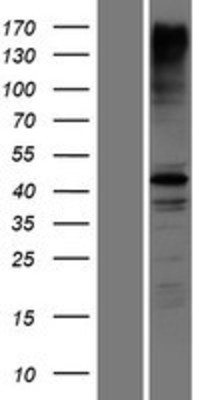 Western Blot: RNF135 Overexpression Lysate (Adult Normal) [NBP2-06044] Left-Empty vector transfected control cell lysate (HEK293 cell lysate); Right -Over-expression Lysate for RNF135.