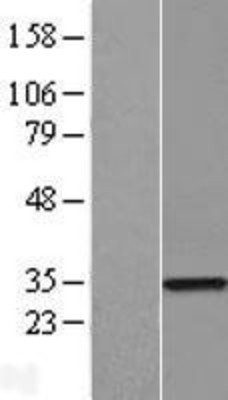 Western Blot: ZNF323 Overexpression Lysate (Adult Normal) [NBP2-06170] Left-Empty vector transfected control cell lysate (HEK293 cell lysate); Right -Over-expression Lysate for ZNF323.