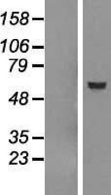 Western Blot: Dfna5 deafness Overexpression Lysate (Adult Normal) [NBP2-11376] Left-Empty vector transfected control cell lysate (HEK293 cell lysate); Right -Over-expression Lysate for Dfna5 deafness.