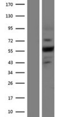 Western Blot: Plexin A4 Overexpression Lysate (Adult Normal) [NBP2-11421] Left-Empty vector transfected control cell lysate (HEK293 cell lysate); Right -Over-expression Lysate for Plexin A4.