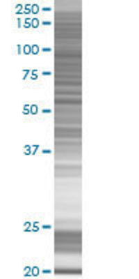 FGD6 transfected lysate.