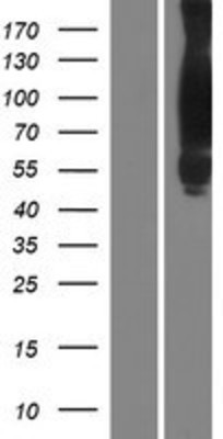 Western Blot: Cortactin Overexpression Lysate (Adult Normal) [NBP2-11308] Left-Empty vector transfected control cell lysate (HEK293 cell lysate); Right -Over-expression Lysate for Cortactin.