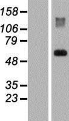 Western Blot: HGFA Inhibitor 1 Overexpression Lysate (Adult Normal) [NBP2-11603] Left-Empty vector transfected control cell lysate (HEK293 cell lysate); Right -Over-expression Lysate for HGFA Inhibitor 1.