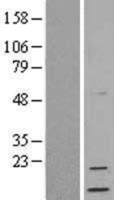 Western Blot: Neuritin Overexpression Lysate (Adult Normal) [NBL1-13797] Left-Empty vector transfected control cell lysate (HEK293 cell lysate); Right -Over-expression Lysate for Neuritin.