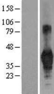 Western Blot: CD40 Overexpression Lysate (Adult Normal) [NBL1-08948] Left-Empty vector transfected control cell lysate (HEK293 cell lysate); Right -Over-expression Lysate for CD40.