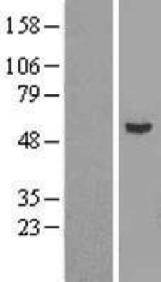 Western Blot: Epsilon 1 Tubulin Overexpression Lysate (Adult Normal) [NBL1-17443] Left-Empty vector transfected control cell lysate (HEK293 cell lysate); Right -Over-expression Lysate for Epsilon 1 Tubulin.