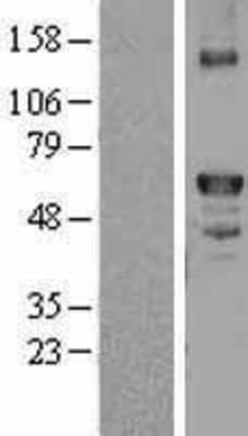 Western Blot: Factor X Overexpression Lysate (Adult Normal) [NBL1-10402] Left-Empty vector transfected control cell lysate (HEK293 cell lysate); Right -Over-expression Lysate for Factor X.