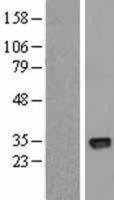Western Blot: CTDSPL Overexpression Lysate (Adult Normal) [NBL1-09569] Left-Empty vector transfected control cell lysate (HEK293 cell lysate); Right -Over-expression Lysate for CTDSPL.