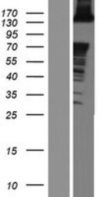 Western Blot: ABL2 Overexpression Lysate (Adult Normal) [NBL1-07210] Left-Empty vector transfected control cell lysate (HEK293 cell lysate); Right -Over-expression Lysate for ABL2.