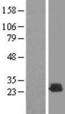 Western Blot: Recoverin Overexpression Lysate (Adult Normal) [NBL1-15251] Left-Empty vector transfected control cell lysate (HEK293 cell lysate); Right -Over-expression Lysate for Recoverin.