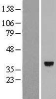 Western Blot: calmodulin-lysine N-methyltransferase Overexpression Lysate (Adult Normal) [NBL1-08411] Left-Empty vector transfected control cell lysate (HEK293 cell lysate); Right -Over-expression Lysate for calmodulin-lysine N-methyltransferase.