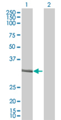 Lane 1: HFE2 transfected lysate (33.7 KDa) Lane 2: Non-transfected lysate.