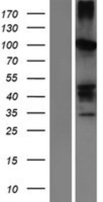 Western Blot: SERPINB11 Overexpression Lysate (Adult Normal) [NBP2-05784] Left-Empty vector transfected control cell lysate (HEK293 cell lysate); Right -Over-expression Lysate for SERPINB11.