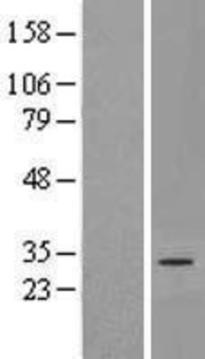 Western Blot: DNAJC22 Overexpression Lysate (Adult Normal) [NBP2-06271] Left-Empty vector transfected control cell lysate (HEK293 cell lysate); Right -Over-expression Lysate for DNAJC22.