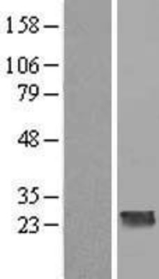 Western Blot: CCDC70 Overexpression Lysate (Adult Normal) [NBL1-08816] Left-Empty vector transfected control cell lysate (HEK293 cell lysate); Right -Over-expression Lysate for CCDC70.