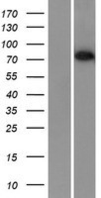 Western Blot: BORIS Overexpression Lysate (Adult Normal) [NBL1-09565] Left-Empty vector transfected control cell lysate (HEK293 cell lysate); Right -Over-expression Lysate for BORIS.