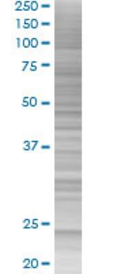Western Blot: Factor VIII Overexpression Lysate (Denatured) [H00002157-T01] - F8 transfected lysate.