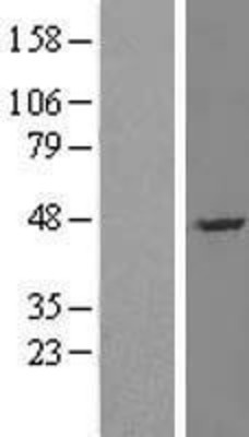 Western Blot: NADE Overexpression Lysate (Adult Normal) [NBP2-10324] Left-Empty vector transfected control cell lysate (HEK293 cell lysate); Right -Over-expression Lysate for NADE.