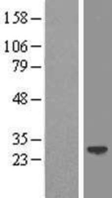 Western Blot: LIN7 Overexpression Lysate (Adult Normal) [NBP2-10532] Left-Empty vector transfected control cell lysate (HEK293 cell lysate); Right -Over-expression Lysate for LIN7.