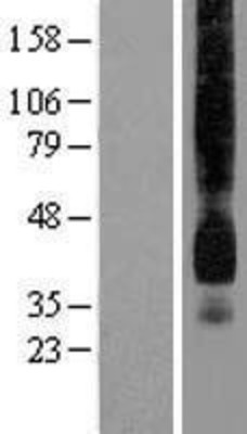 Western Blot: GLUT1 Overexpression Lysate (Adult Normal) [NBP2-10406] Left-Empty vector transfected control cell lysate (HEK293 cell lysate); Right -Over-expression Lysate for GLUT1.